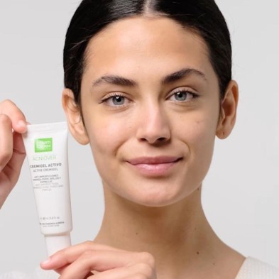 MARTIDERM ACNIOVER CREMIGEL ACTIVO 40 ML