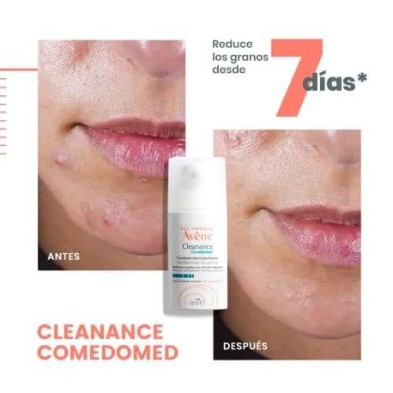 Cleanance Comedomed Concentrado